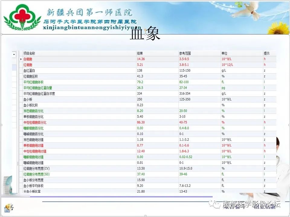 影像PPT - 【病例】卵巢纤维卵泡膜细胞瘤1例CT及MR-5 影像PPT - 【病例】卵巢纤维卵泡膜细胞瘤1例CT及MR-5