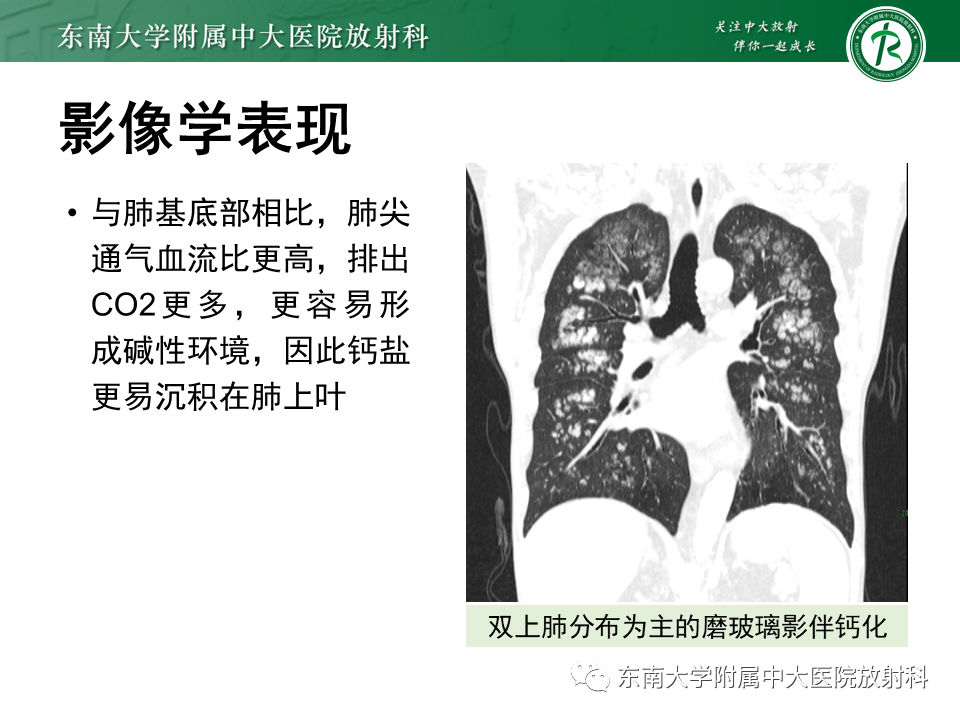 影像PPT - 【PPT】肺转移性钙化影像表现及其鉴别诊断-10 影像PPT - 【PPT】肺转移性钙化影像表现及其鉴别诊断-10