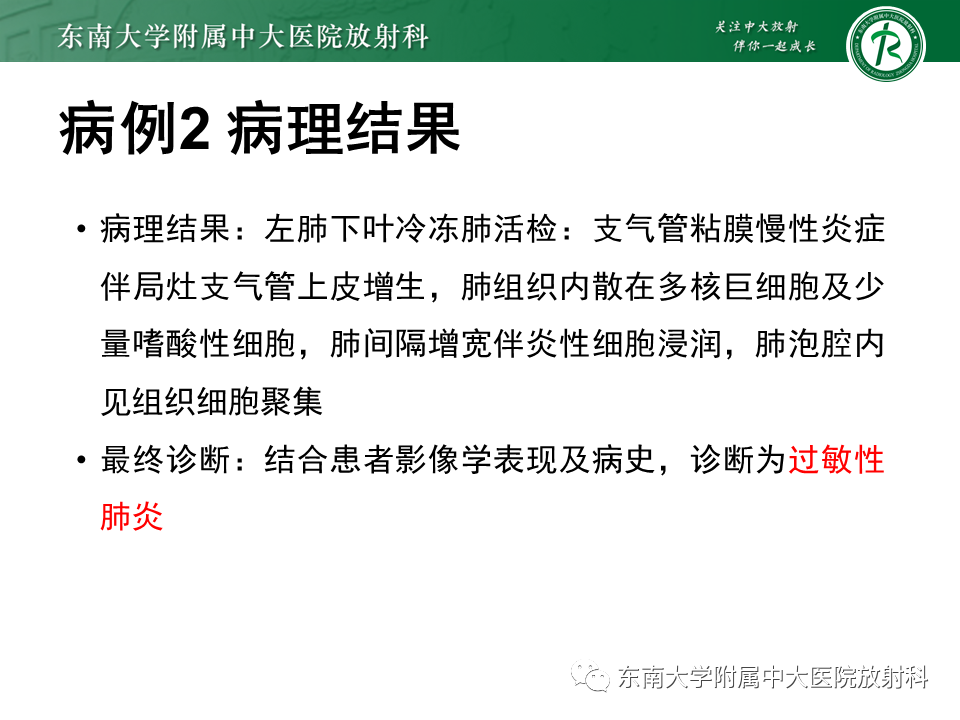 影像PPT - 【PPT】肺转移性钙化影像表现及其鉴别诊断-22 影像PPT - 【PPT】肺转移性钙化影像表现及其鉴别诊断-22