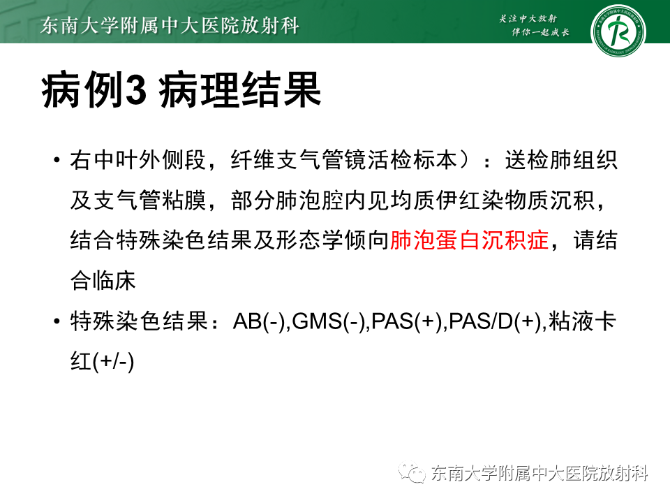 影像PPT - 【PPT】肺转移性钙化影像表现及其鉴别诊断-29 影像PPT - 【PPT】肺转移性钙化影像表现及其鉴别诊断-29