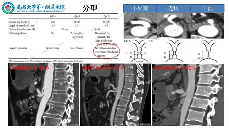 影像PPT - 【PPT】腹部血管性病变急腹症的影像诊断-32