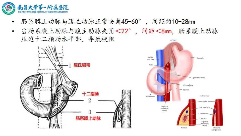 影像PPT - 【PPT】腹部血管性病变急腹症的影像诊断-35