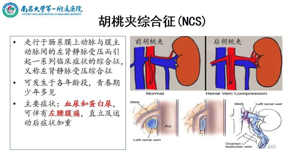 影像PPT - 【PPT】腹部血管性病变急腹症的影像诊断-38