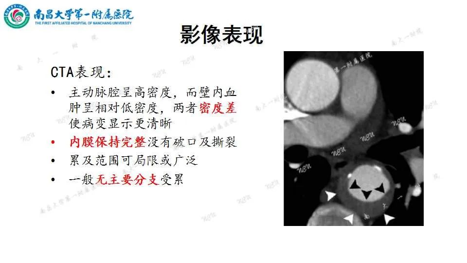 影像PPT - 【PPT】腹部血管性病变急腹症的影像诊断-50