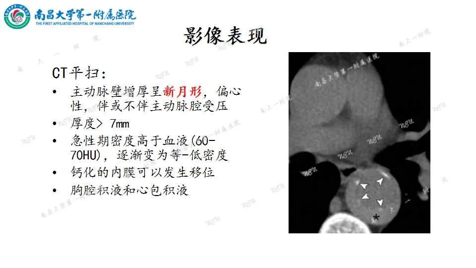 影像PPT - 【PPT】腹部血管性病变急腹症的影像诊断-49