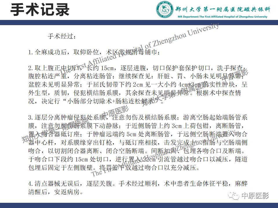 影像PPT - 【病例】小肠间质瘤1例MR影像-8