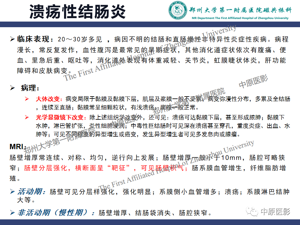 影像PPT - 【病例】小肠间质瘤1例MR影像-15