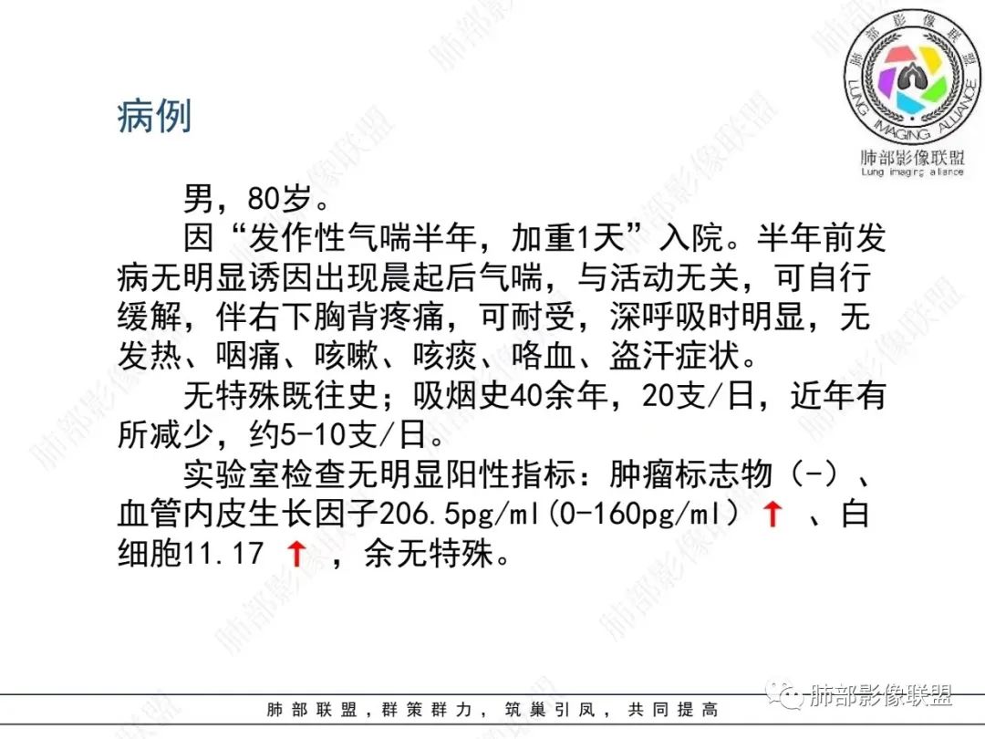 影像PPT - 【病例】胸膜下的“山丘”—肺大细胞神经内分泌癌1例CT-2 影像PPT - 【病例】胸膜下的“山丘”—肺大细胞神经内分泌癌1例CT-2