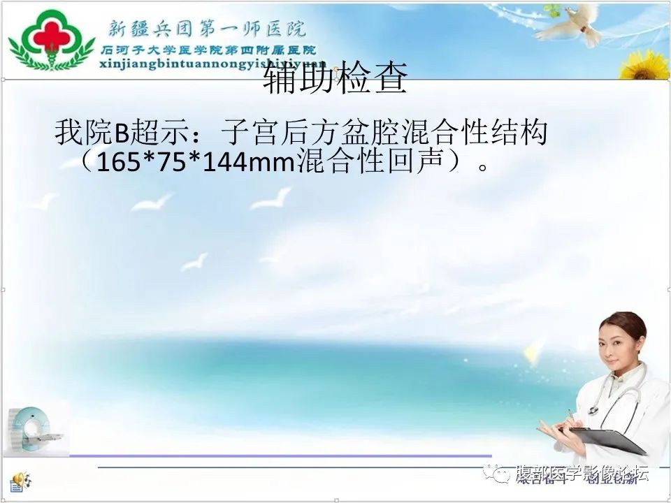 影像PPT - 【病例】盆腔混合型性索间质肿瘤1例CT及MR-4 影像PPT - 【病例】盆腔混合型性索间质肿瘤1例CT及MR-4