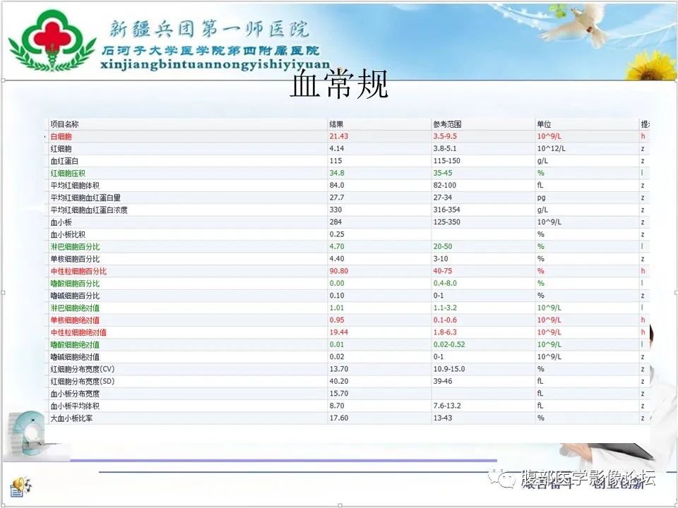 影像PPT - 【病例】盆腔混合型性索间质肿瘤1例CT及MR-5 影像PPT - 【病例】盆腔混合型性索间质肿瘤1例CT及MR-5