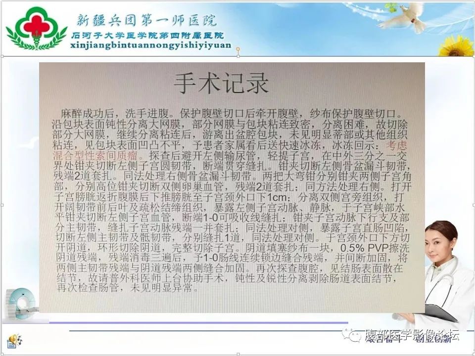 影像PPT - 【病例】盆腔混合型性索间质肿瘤1例CT及MR-2 影像PPT - 【病例】盆腔混合型性索间质肿瘤1例CT及MR-2