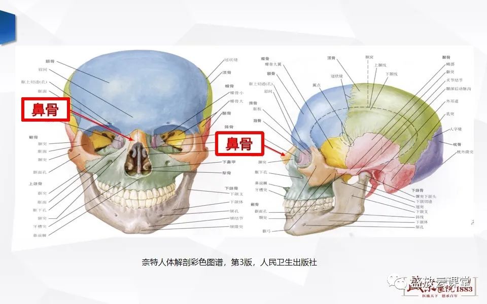 影像PPT - 【PPT】鼻骨正常CT解剖、变异与骨折-4