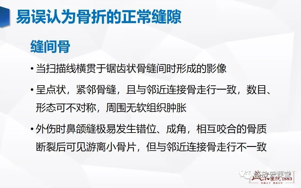 影像PPT - 【PPT】鼻骨正常CT解剖、变异与骨折-16