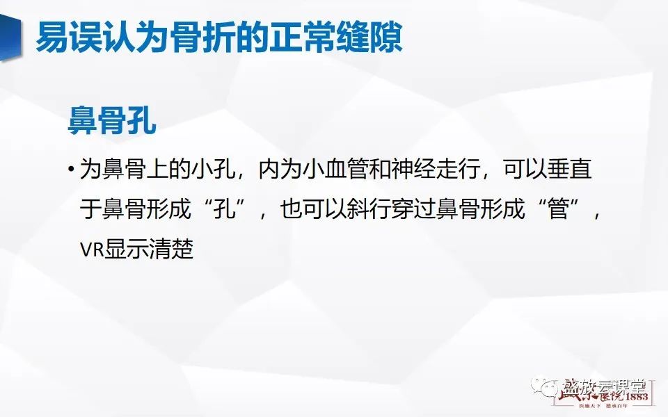 影像PPT - 【PPT】鼻骨正常CT解剖、变异与骨折-18