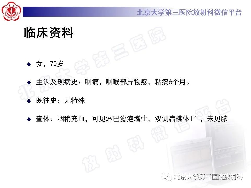 影像PPT - 【PPT】茎突综合征-2