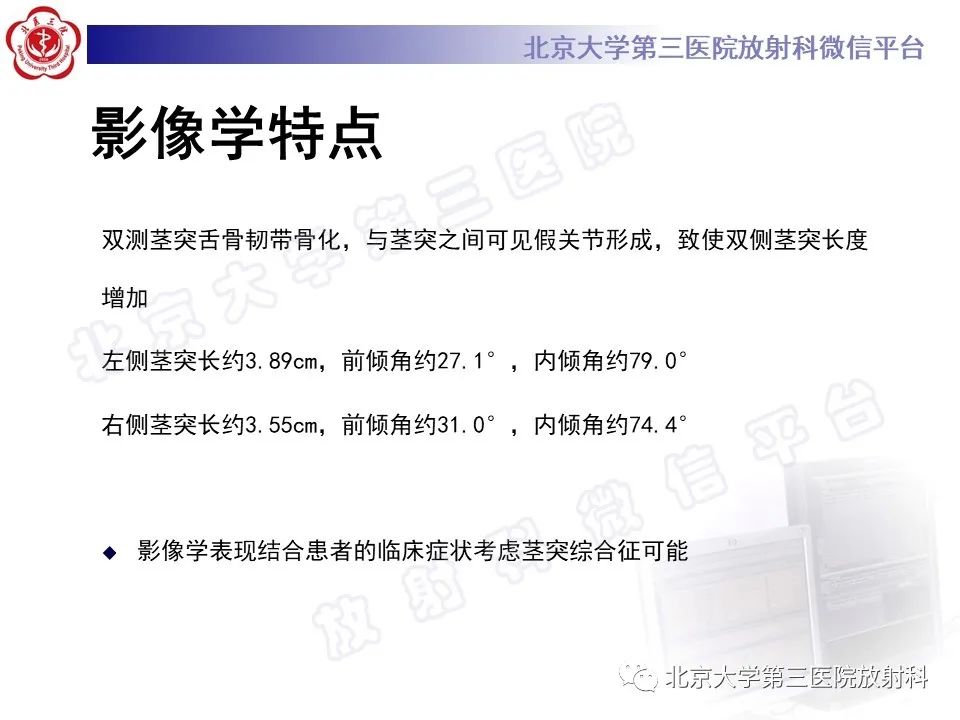 影像PPT - 【PPT】茎突综合征-6