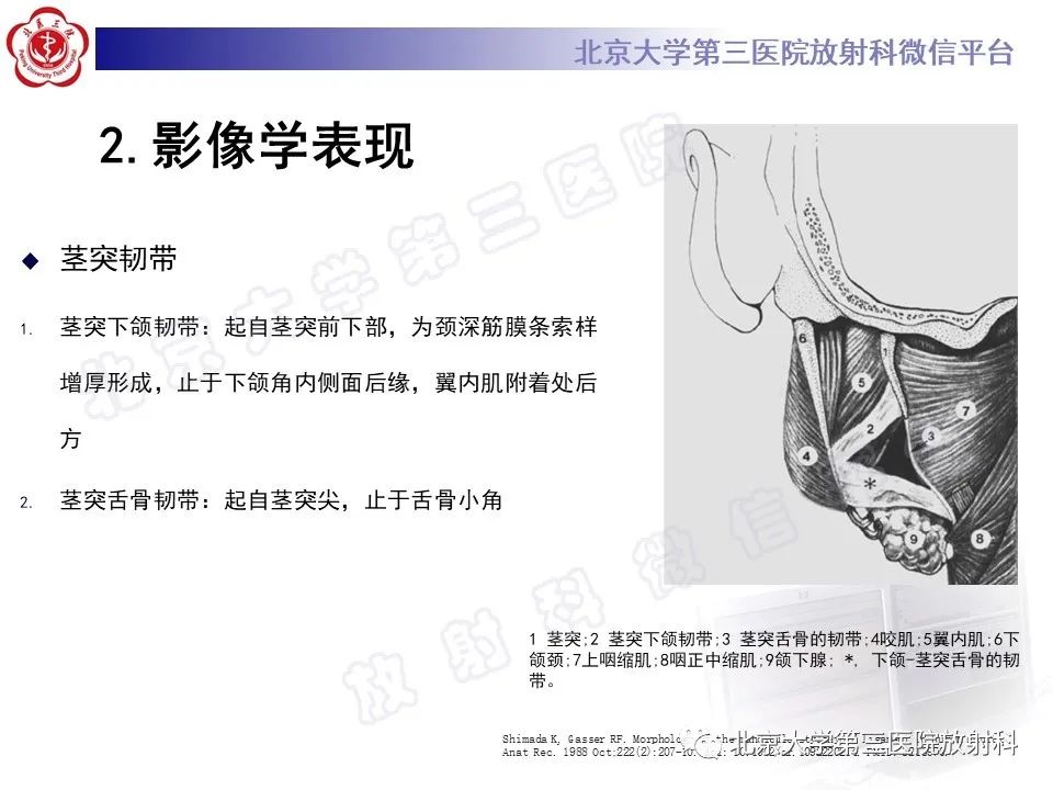 影像PPT - 【PPT】茎突综合征-13