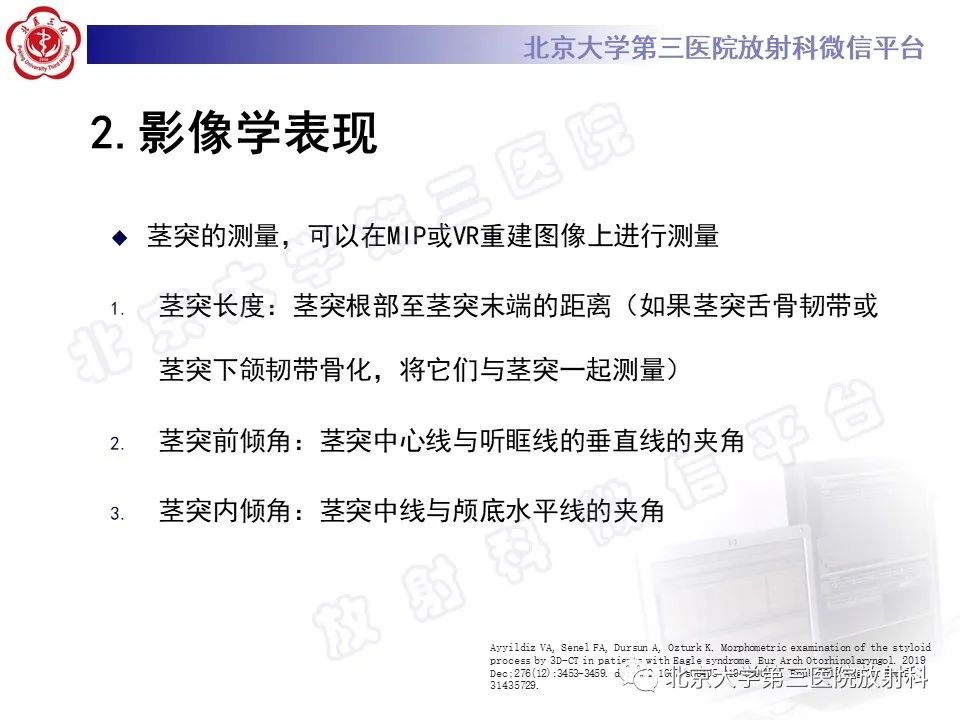 影像PPT - 【PPT】茎突综合征-16