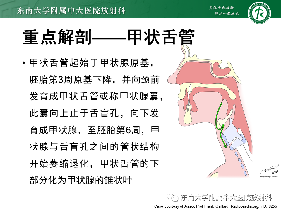 影像PPT - 【PPT】甲状舌管囊肿-4