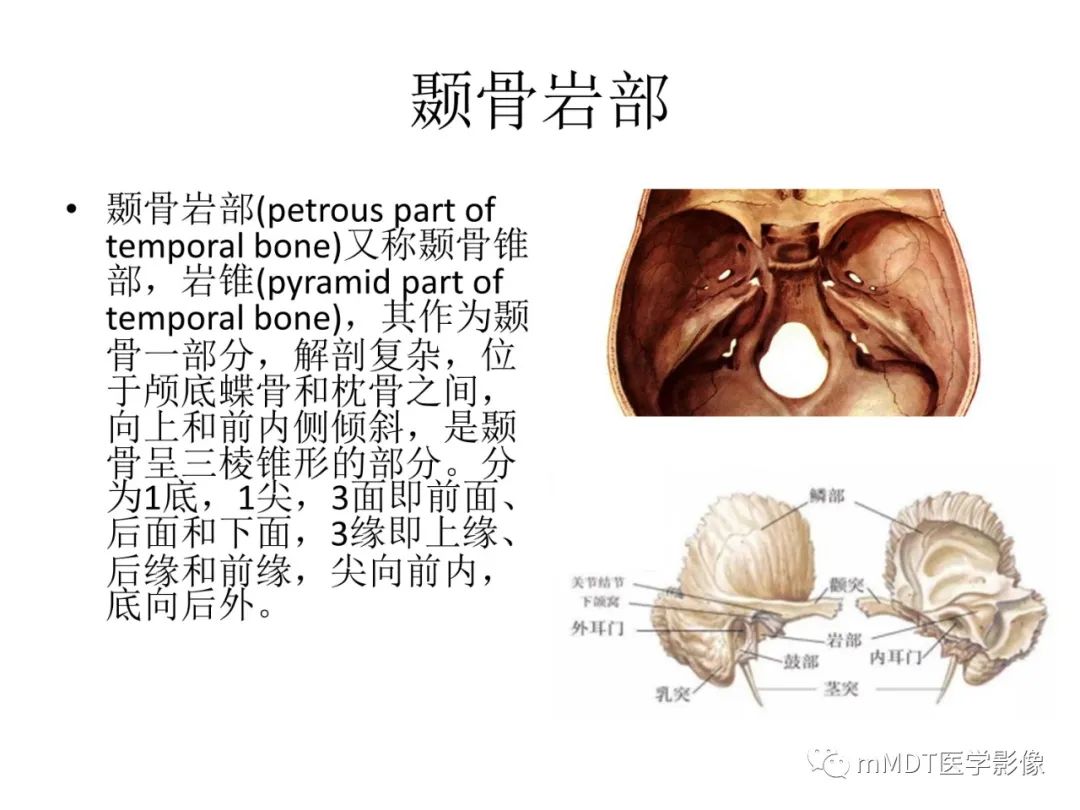 影像PPT - 【病例】岩洞深处藏神仙—穿行在颞骨岩部的神经们-2