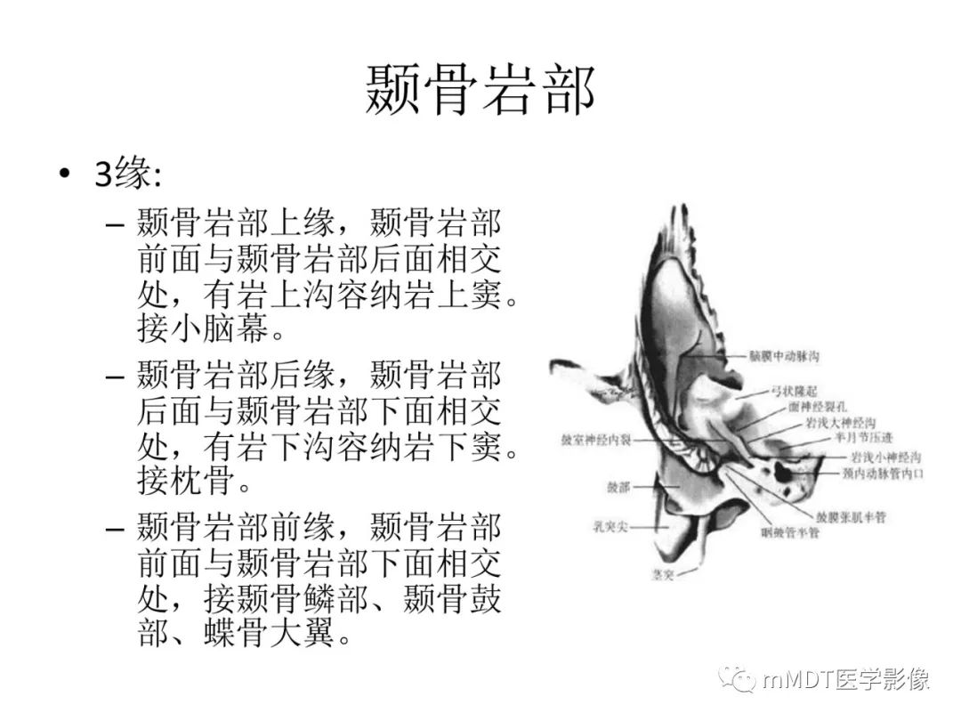 影像PPT - 【病例】岩洞深处藏神仙—穿行在颞骨岩部的神经们-4