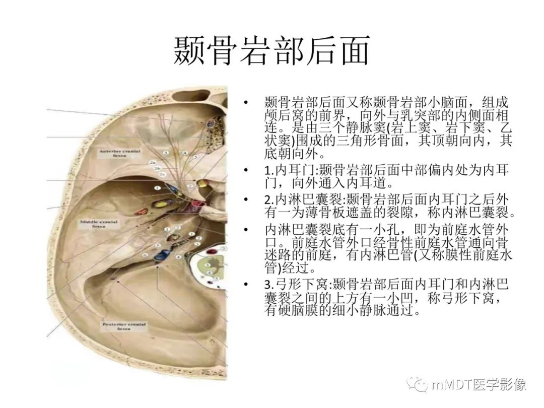 影像PPT - 【病例】岩洞深处藏神仙—穿行在颞骨岩部的神经们-7