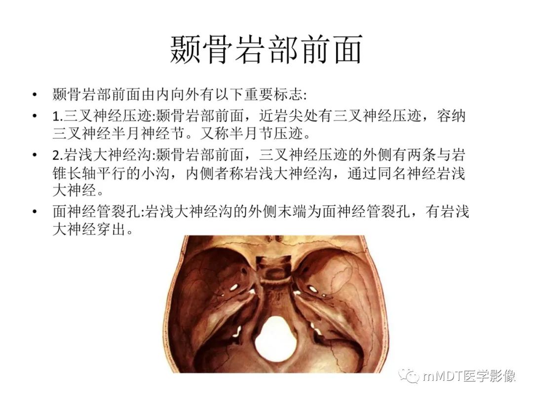 影像PPT - 【病例】岩洞深处藏神仙—穿行在颞骨岩部的神经们-5