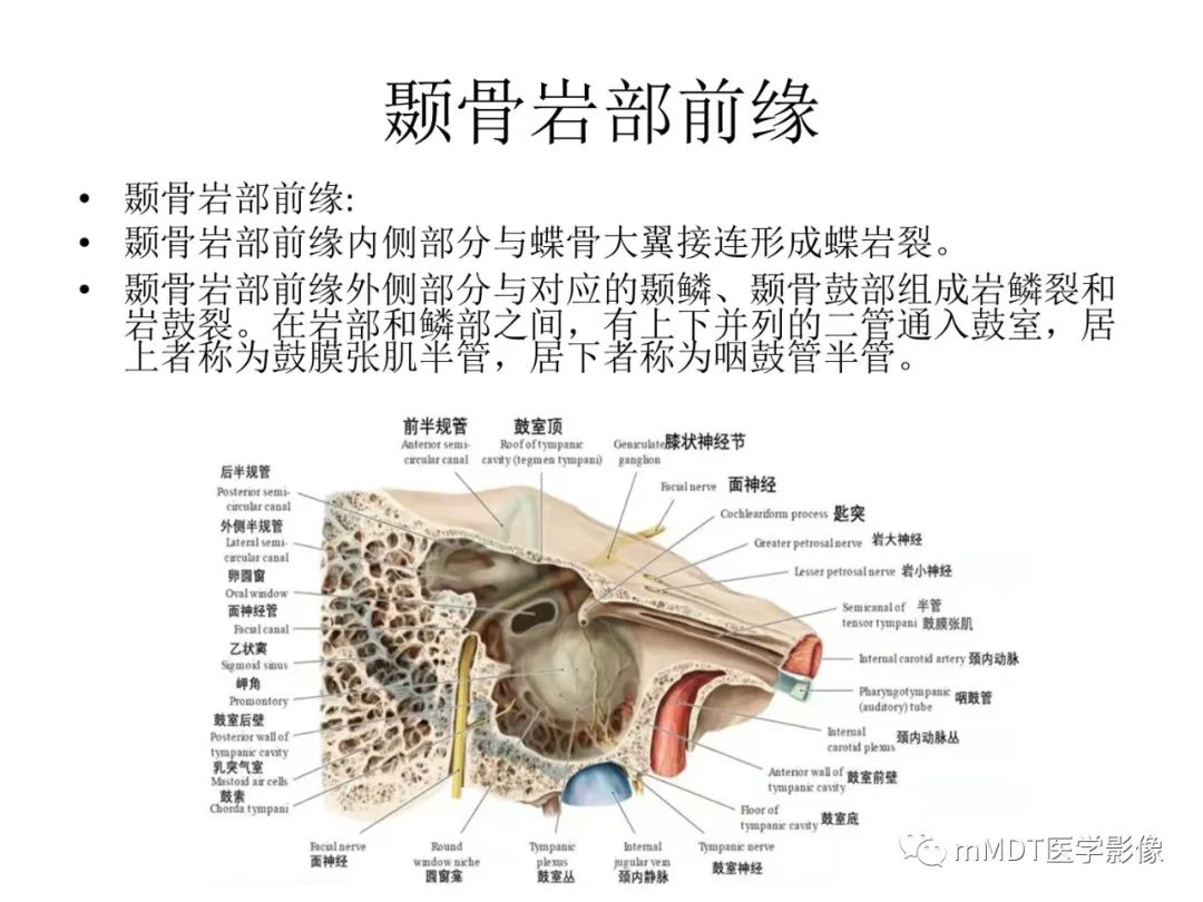 影像PPT - 【病例】岩洞深处藏神仙—穿行在颞骨岩部的神经们-12