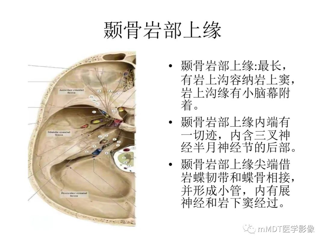 影像PPT - 【病例】岩洞深处藏神仙—穿行在颞骨岩部的神经们-10
