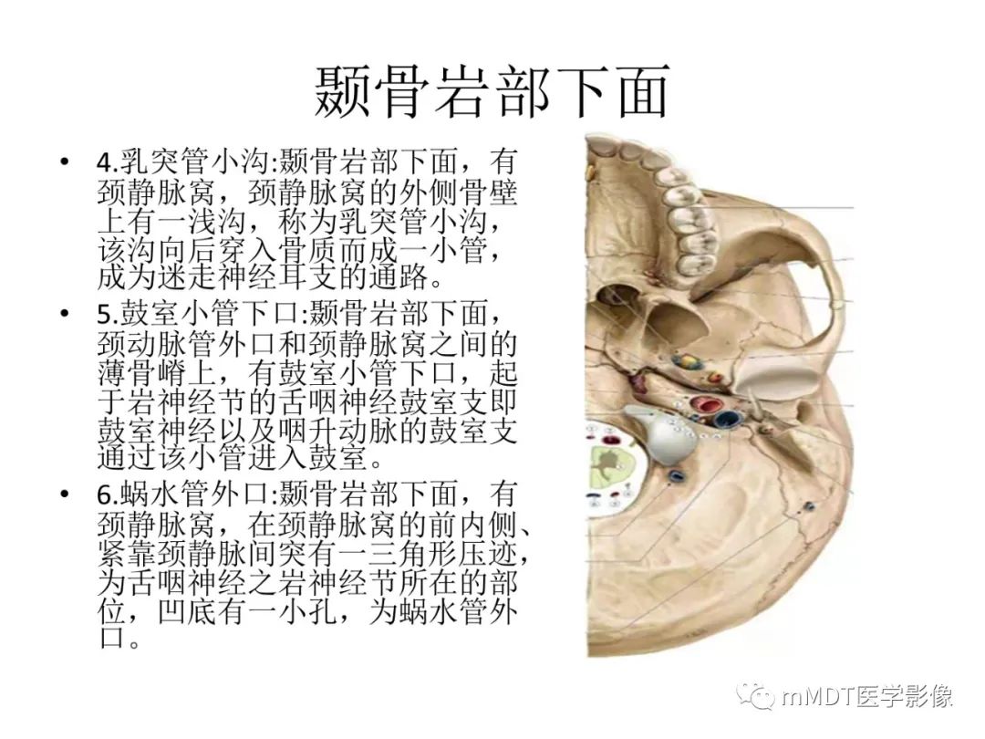 影像PPT - 【病例】岩洞深处藏神仙—穿行在颞骨岩部的神经们-9
