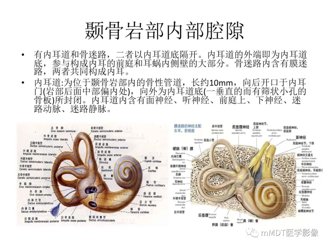 影像PPT - 【病例】岩洞深处藏神仙—穿行在颞骨岩部的神经们-14