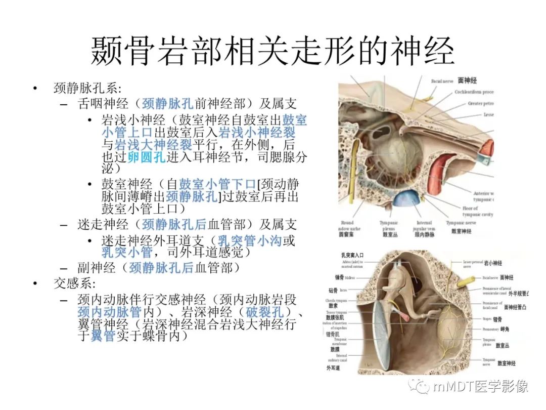 影像PPT - 【病例】岩洞深处藏神仙—穿行在颞骨岩部的神经们-19