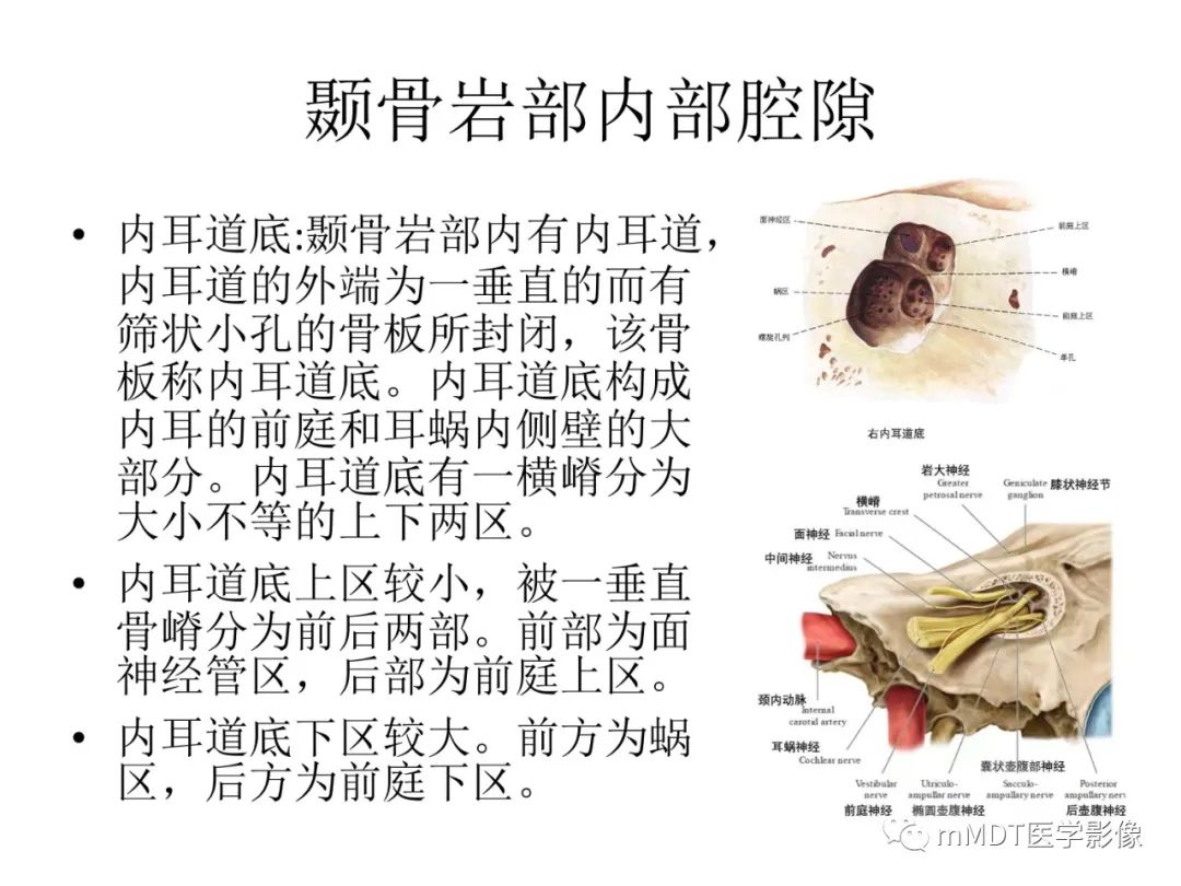 影像PPT - 【病例】岩洞深处藏神仙—穿行在颞骨岩部的神经们-15