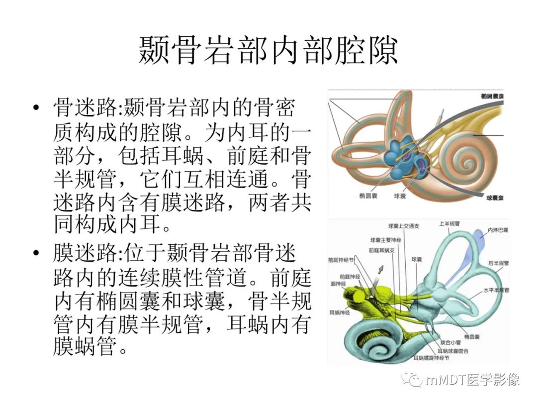 影像PPT - 【病例】岩洞深处藏神仙—穿行在颞骨岩部的神经们-16