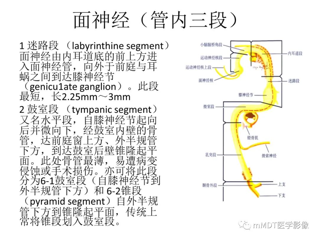 影像PPT - 【病例】岩洞深处藏神仙—穿行在颞骨岩部的神经们-46