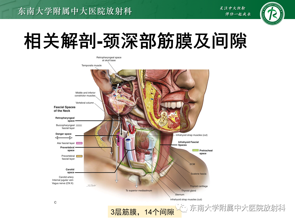影像PPT - 【PPT】颌面部横纹肌肉瘤-6