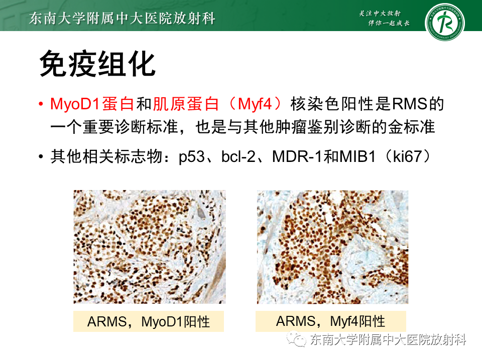 影像PPT - 【PPT】颌面部横纹肌肉瘤-12