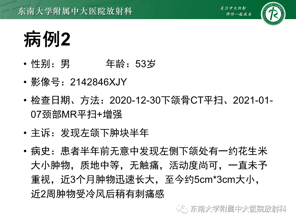 影像PPT - 【PPT】颌面部横纹肌肉瘤-17
