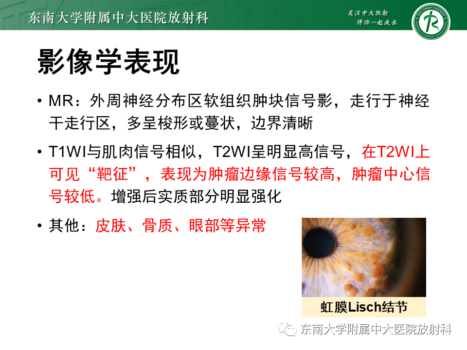 影像PPT - 【PPT】颌面部横纹肌肉瘤-32