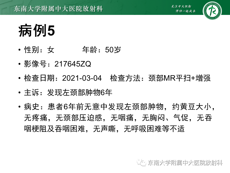 影像PPT - 【PPT】颌面部横纹肌肉瘤-38