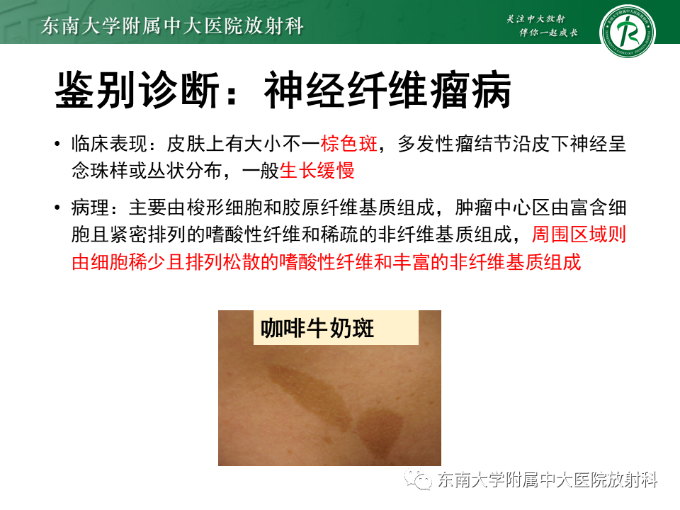 影像PPT - 【PPT】颌面部横纹肌肉瘤-3