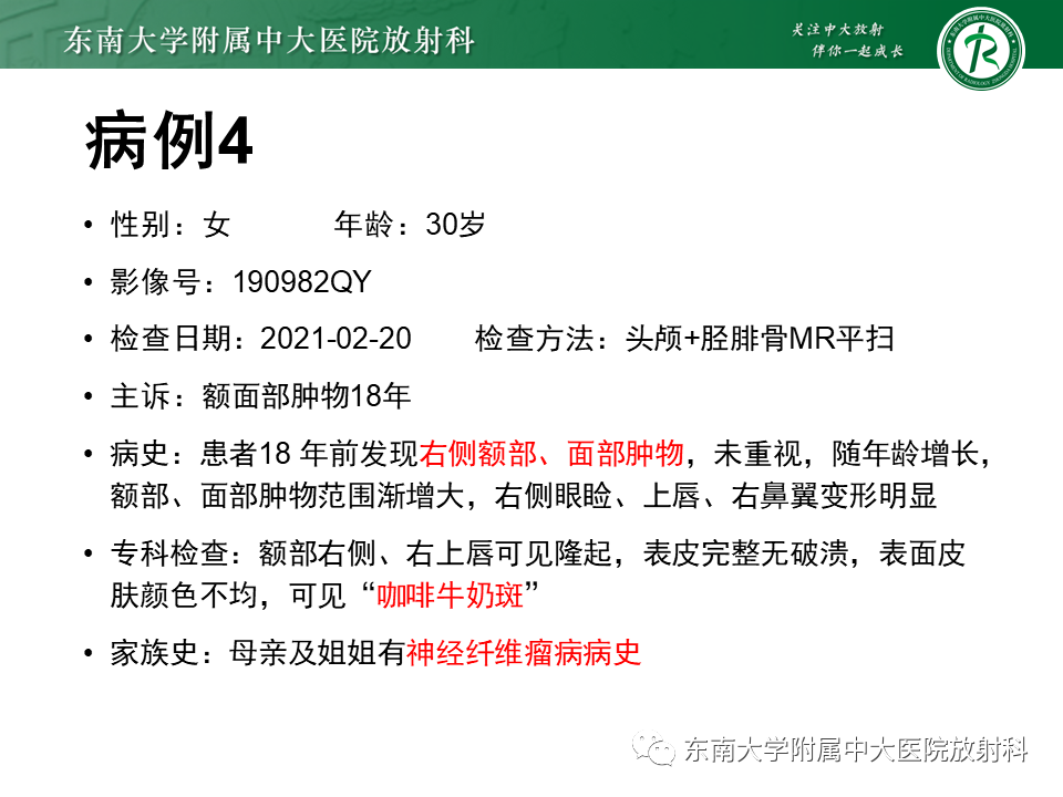 影像PPT - 【PPT】颌面部横纹肌肉瘤-4