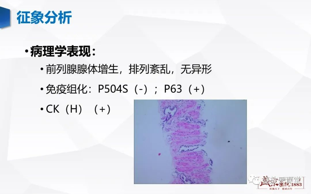 影像PPT - 【PPT】前列腺病变鉴别-6