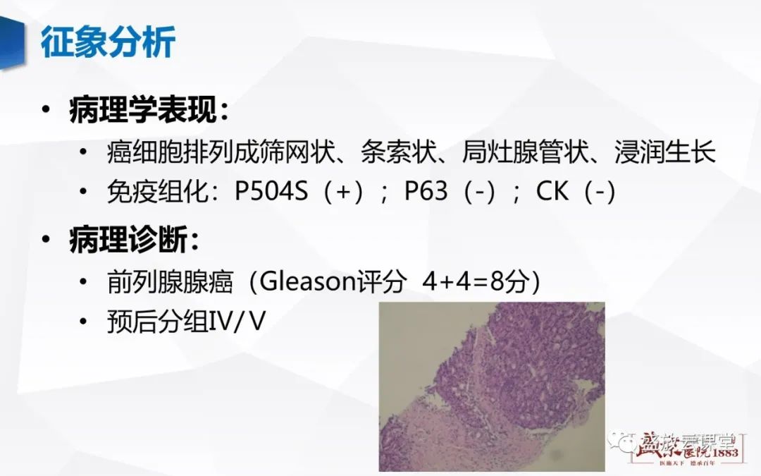 影像PPT - 【PPT】前列腺病变鉴别-14