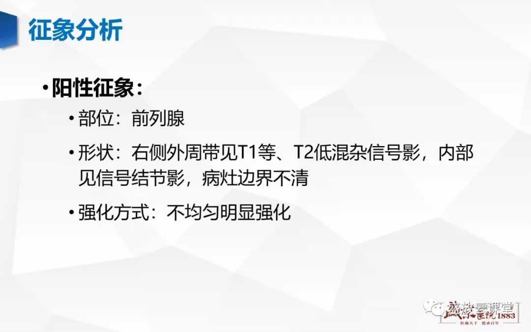 影像PPT - 【PPT】前列腺病变鉴别-27