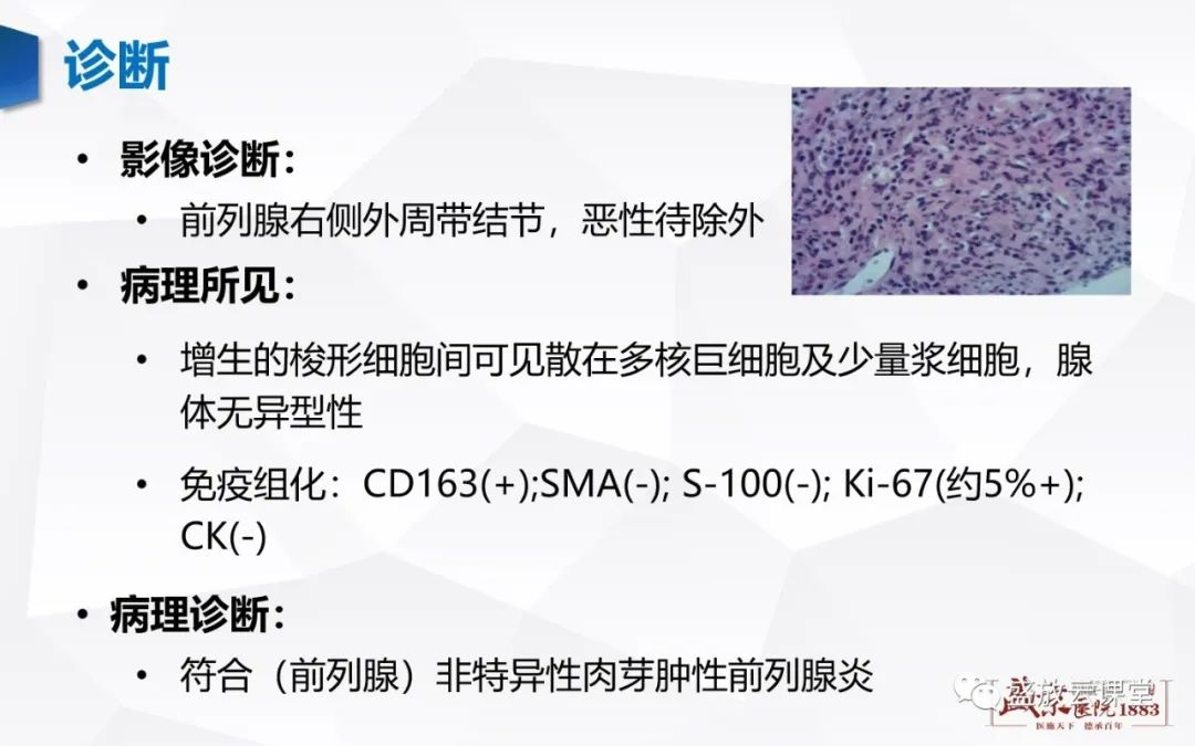 影像PPT - 【PPT】前列腺病变鉴别-28