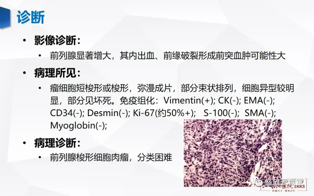 影像PPT - 【PPT】前列腺病变鉴别-33