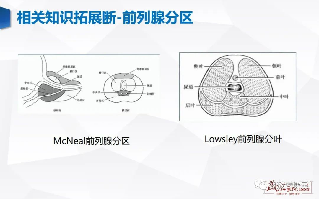 影像PPT - 【PPT】前列腺病变鉴别-37