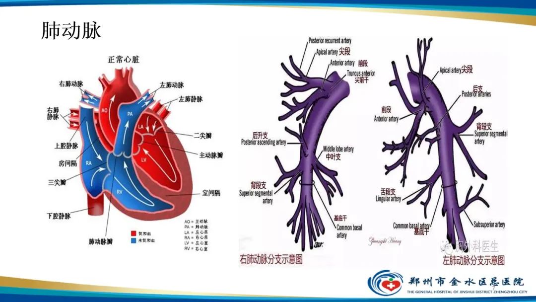 影像PPT - 【PPT】肺动脉CTA扫描技术-7