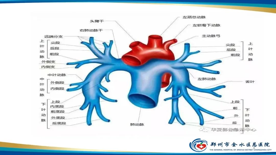 影像PPT - 【PPT】肺动脉CTA扫描技术-8